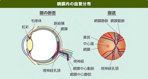 網膜静脈閉塞症