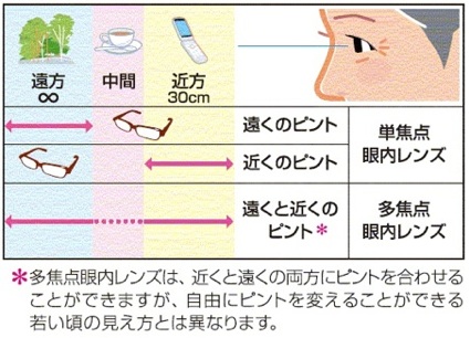 メガネの必要性