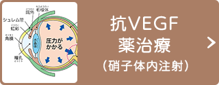 抗VEGF薬治療（硝子体内注射）